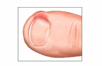 Northwich Foot Clinic And Physiotherapy Cheshire North West